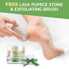 Activelife Advanced Urea+ Cream Formulated by Doctors Callus Remover Moisturizes Body and Rehydrates Cracked, Rough Dead Skin of Feet Hands and Elbows - ActiveLifeUSA.com